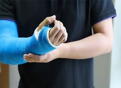 تصویر 4 از قیمت خرید گچ ارتوپدی ضد آب + فروش ویژه